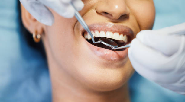 Best Dentist for Tooth Abscess  in Trotwood, OH